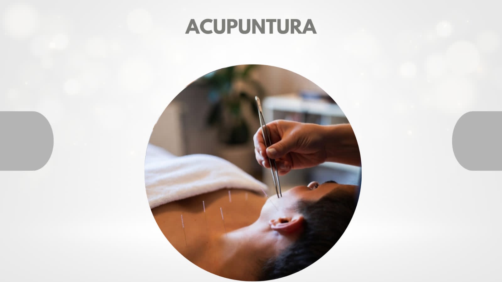Acupuntura.jpg
